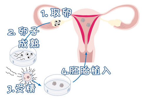 张医生